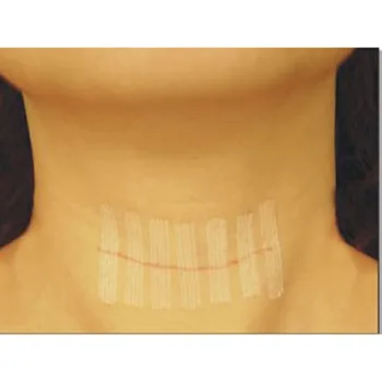 

6*38mm 6strips/ Bag Sterile First Aid Travel Kit Used Medical Surgical Adhesive Wound Skin Closures Steri Strip