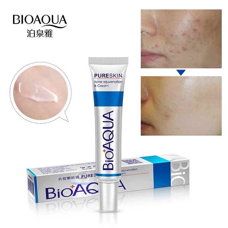 Средство по уходу за лицом от прыщей BIOAQUA крем для лечения акне сужение пор