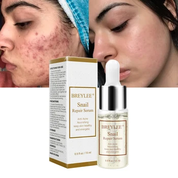 

1PCS Serum Repairing Scars Anti-Acne Rejuvenation Moisturizing Essence Acne Reatment Nourishing Face Skin Care TSLM1