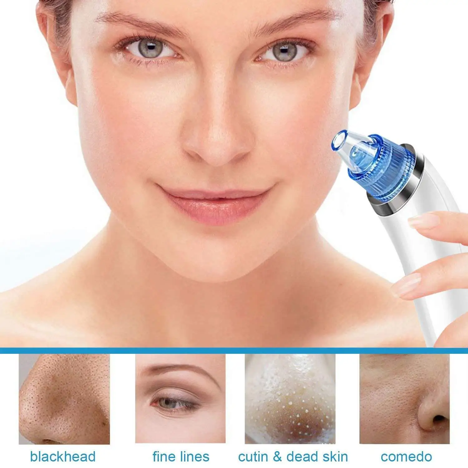 50343 Blackhead Remover Portable Facial Pore Vacuum Painlessly » Gadget mou