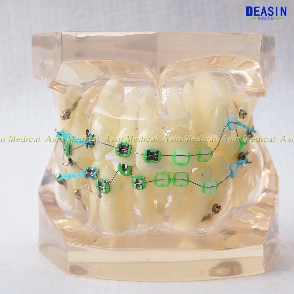 1 шт. ортодонтов зубы модель с металлической и керамические кронштейны Орто металлические стоматолог пациента студент модель обучения Deasin