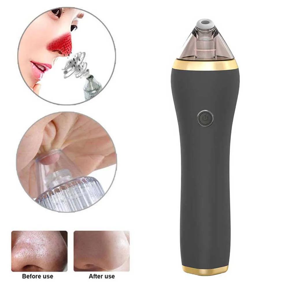 Пылесос Blackhead очиститель акне устройство для удаления черных точек Электрический очищающее средство для кожи лица Уход за носом Очищающая машина для медицинских банок уход за кожей# y3