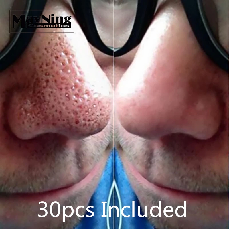 

Nose Strips 30pcs Remove Blackhead Black Mask Get Rid of Black Dots on Noses Jaws Forehead Minimize Pores Cleanser Easily