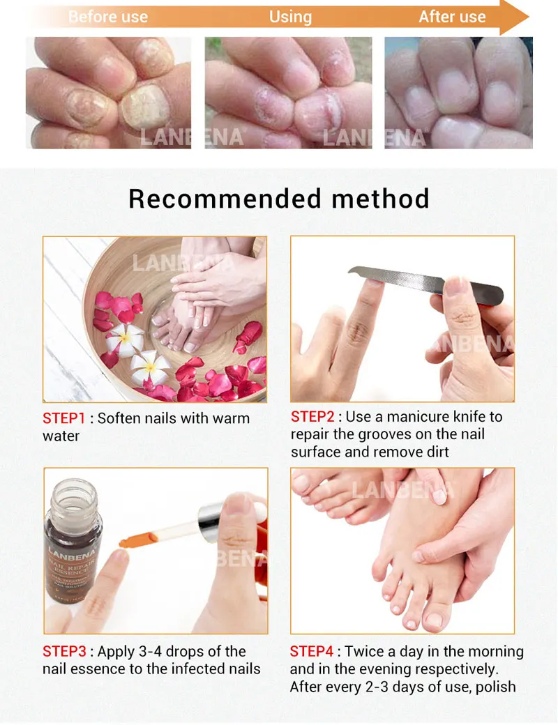 nail-repair-essence-5_01