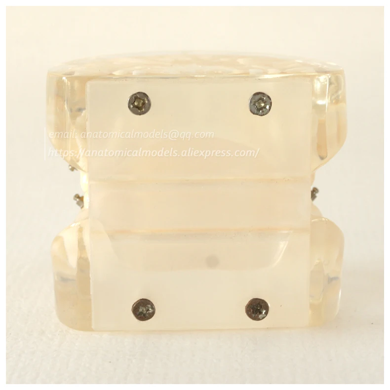 13022 DH202 Orthodontic Model 3 