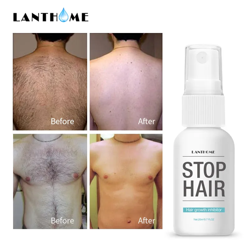 

Prevents Hair Growth Inhibitor Spray Reduce Hair Growth Whole Body Leg Body Armpit Hands Facial Depilation Essence Liquid