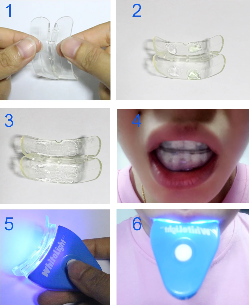 Pboon отбеливатель зубов белый светильник для отбеливания зубов с 2 шт. Отбеливающие гели и светодиодный светильник
