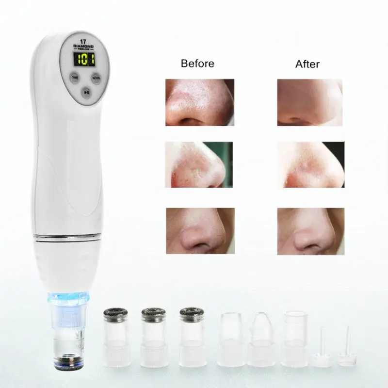 Electronic Blackhead Remover Skin Diamond Dermabrasion With 6 Tips For Scar Acne Pore Deep Cleaning Peeling