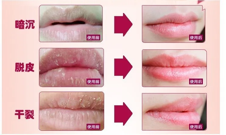 Lip Exfoliating6