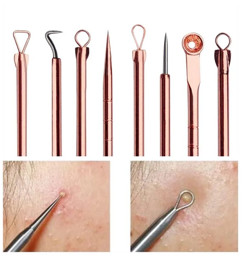 

4pcs Stainless Steel Blackhead Remover Tool Kit Professional Blackhead Acne Comedone Pimple Blemish Extractor Beauty Tool