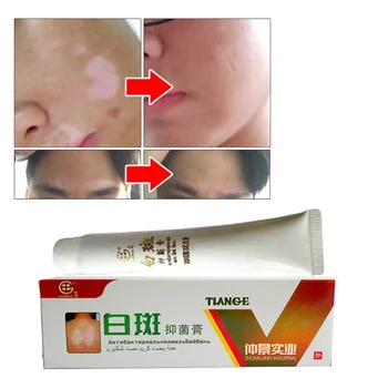 1 pc 30g chinois médical tache blanche maladie crème Pigment mélanine favorisant Liniment peau Vitiligo leucoplakia traitement de la maladie