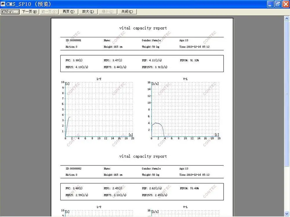 Seguro à Porta Dispositivo de Volume Pulmonar + Software de Computador Embalado Spirômetro Contec Sp10 Pulmonar Respiratório Função * Bem 5 * Bem embalado seguro à porta *