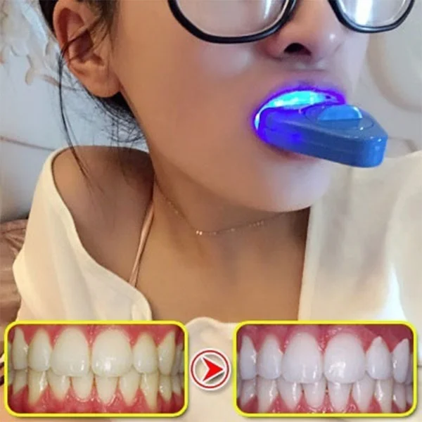 

Teeth Cold Whitening Lights Dental Tools Gel Bleaching Dental Clareamento Dental Bright White Light Clareamento Diagnostic-tool