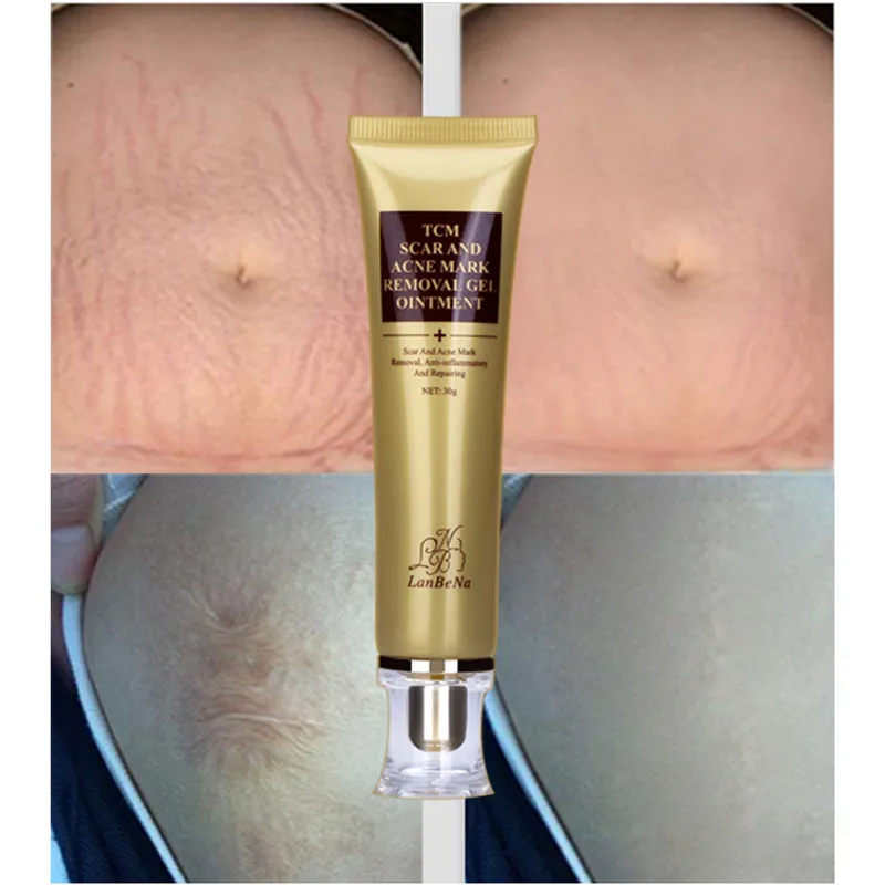 LANBENA-Acn-d-placement-de-Cicatrice-Cr-me-R-paration-de-La-Peau-Cr-me-Pour (4)_