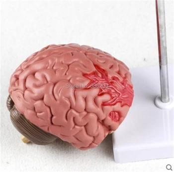

life size Human disease brain Education Model Teach Disease of the Brain Anatomy Nurse Training Study Display