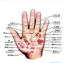 Electronic acupuncture pen electronic pulse stimulator electronic acupuncture apparatus acupuncture point stimulator detector muscle massage needle stimulator cmns6 1 electronic acupuncture 6 output channel newest jia jian acupuncture needle stimulator