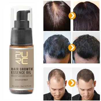 

20ml Hair Growth Oil Hair Loss Treatment Help For Hair Growth Hair Care Nutrition Liquid Tratamiento Para El Cabello