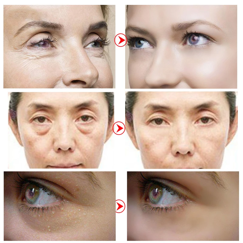 60PCS Anti Wrinkle Eye Mask Eye Patches Mask Crystal Collagen Under the Eyes Sleep Mask Remove Dark Circles Hydrogel Patch