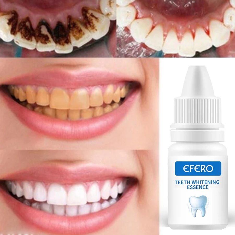 

Removes Plaque Stains Teeth Whitening Essence Oral Hygiene Teeth Care Cleaning Bleaching Tooth Serum Dental Tools Toothpaste