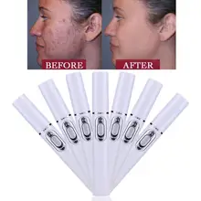 От акне лазерная ручка портативное устройство для разглаживания складок прочное мягкое устройство для удаления шрамов синяя светотерапия ручка уход за лицом инструмент