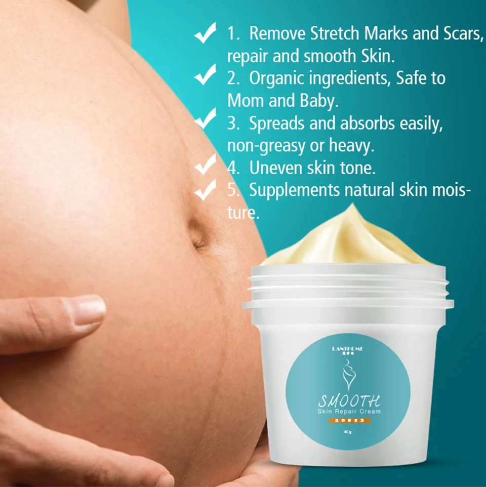 40G Natural Pregnancy Stretch Marks Remover Cream Acne Scar Removal Cream Skin Repair Anti-Aging Anti Winkles Firming Body Cream