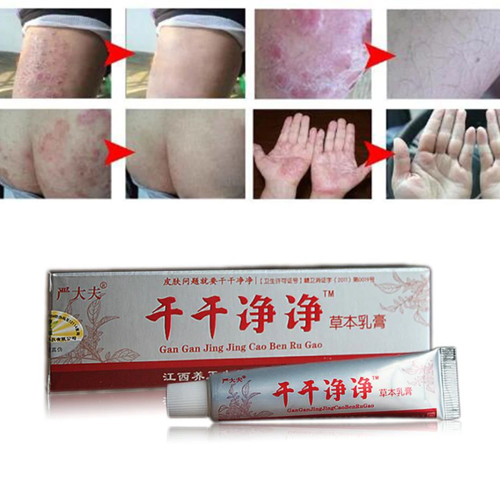 15 г китайская Кнопка тревожного вызова для тела псориаз, дерматит и экземы зуд псориаз кожи проблемы Китай крема для век псориаз крема для век D187