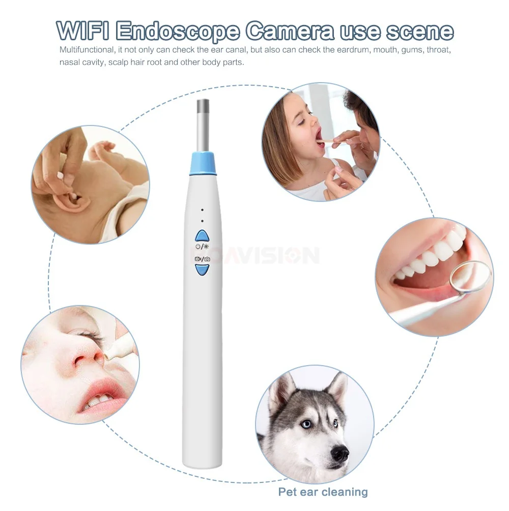 02 Otoscope 