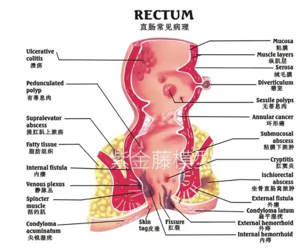 QQ20190114142024