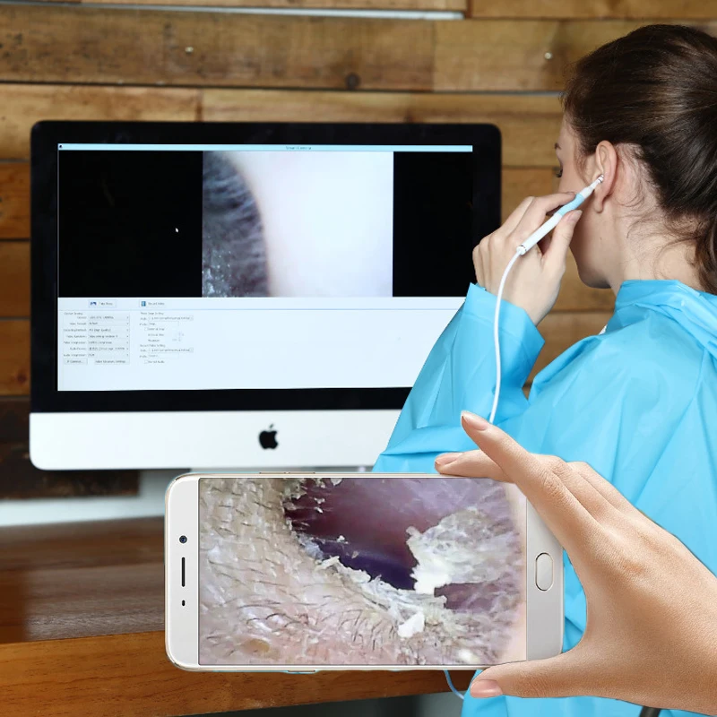 Синий Wifi медицинский USB 720P HD визуальный ушной эндоскоп Отоскоп ложка камера бороскоп Android ПК IOS планшет Iphone ушной инструмент