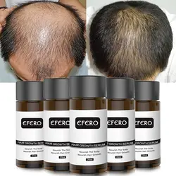 Рост волос эфирное масло быстро мощные средства для волос предотвратить облысение от выпадения волос сыворотка Питательный Уход за