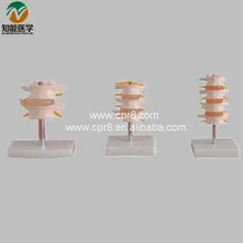Normal Lumbar Set lumbar Vertebrae(2pcs 3pcs 4pcs) BIX-A1010 G162