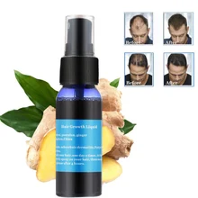 Имбирное эфирное масло средство для роста волос Парикмахерская маска для волос уход за волосами красивые, густые от выпадения волос сыворотка роста волос F