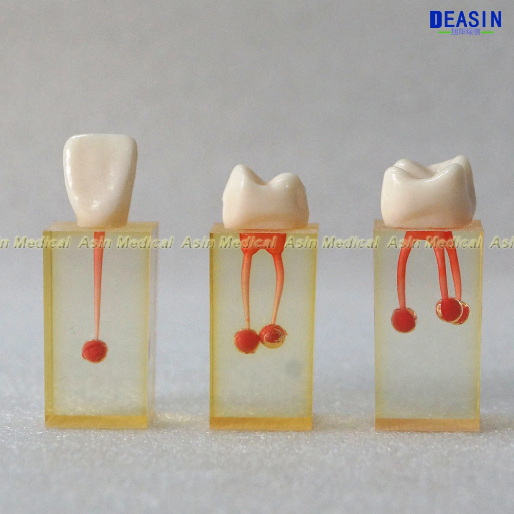 Корневого канала терапии практика модель для стоматологической преподавания и демонстрации
