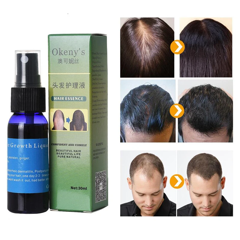 30ml Fast Growth Yuda Pilatory Spray Anti Baldness Hair Care Hair Loss  Treatment Beard Oil Growing Facial Hair Stop Hair Loss - AliExpress Beauty  & Health