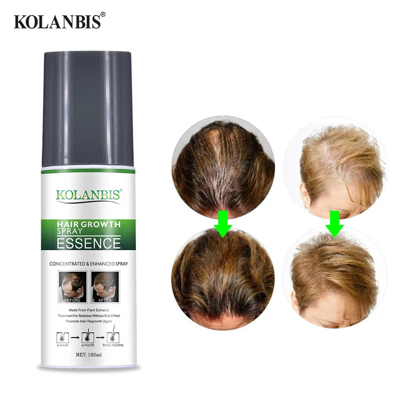 Natural Herbal Hair Fall Growth Oil Essence Tonic For Women