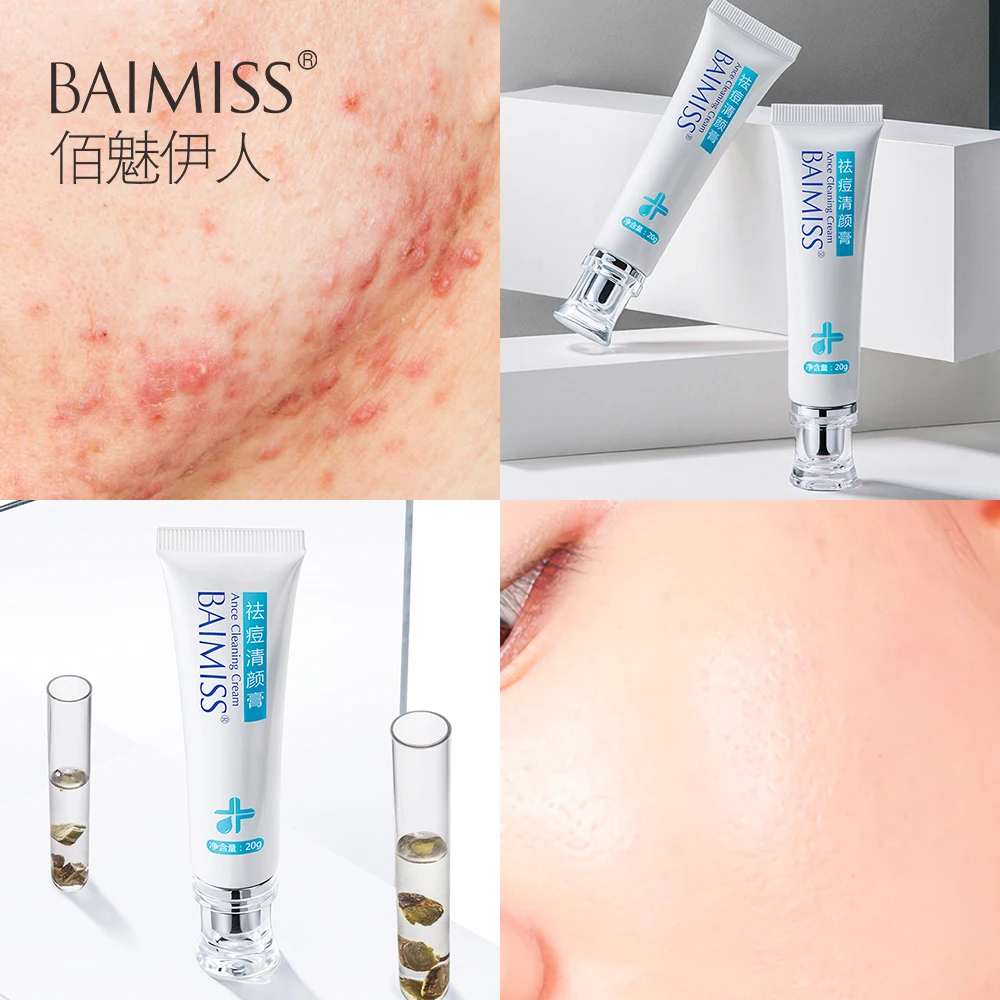 

BAIMISS Acne Cleaning Cream Skin Care Remove Repair Comedone Pimple Acne Quickly Face Acne Cream Remover Anti Acne