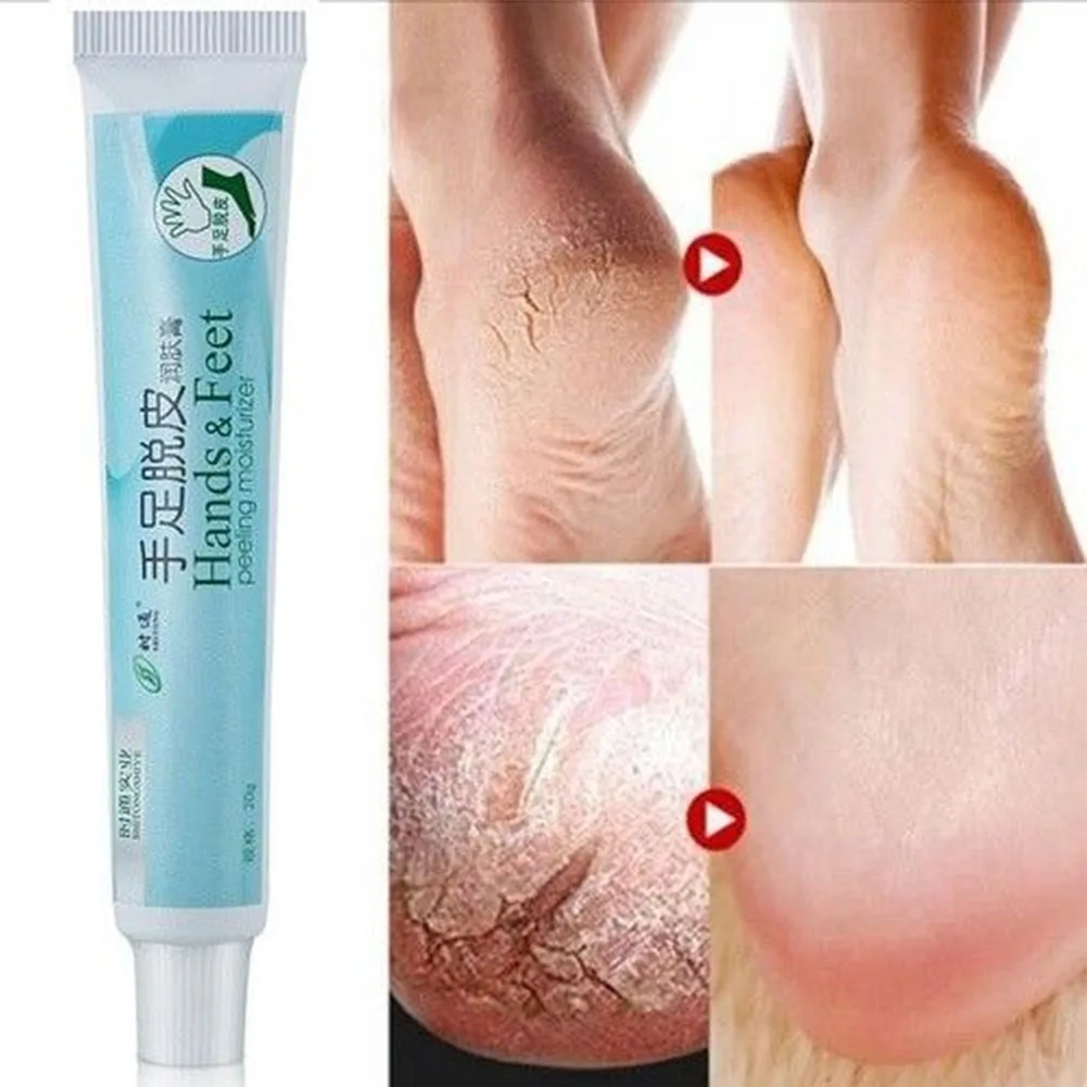 

Skin Care Nourishing Cracked Heel Cosmetics 20g Balm Moisturizing Hand And Foot Refreshing Natural Exfoliating Cream Repair