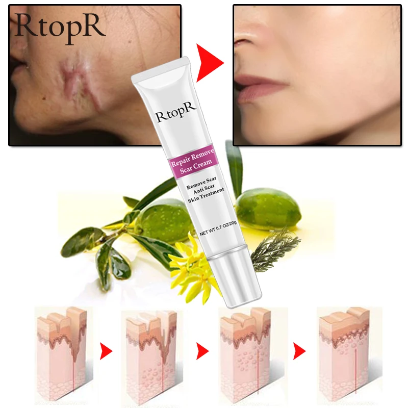 rtopr repair remove scar cream