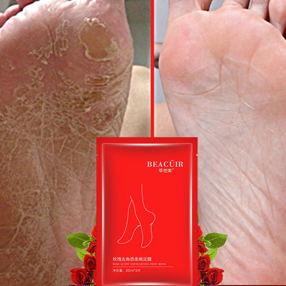 1 Bag Rose Foot Mask Exfoliating Gentle Improves Foot Dryness Whitening