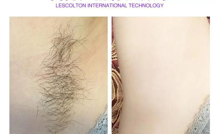 36020170513221352320