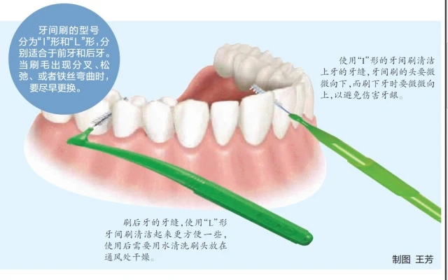 Cleanpik L formas Limpieza межзубные Cepillo межзубные 1,2-1,5 мм зубные Cepillos Cepillo уход за полостью рта cepilo de Dientes De