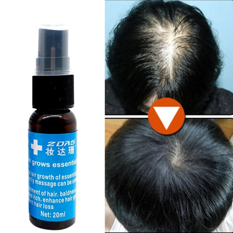 100% Effective Hair Growth Liquid Spray For Women Men Anti Hair Loss Hair Regrowth Dry Hair Repair Moisturizer Treatment