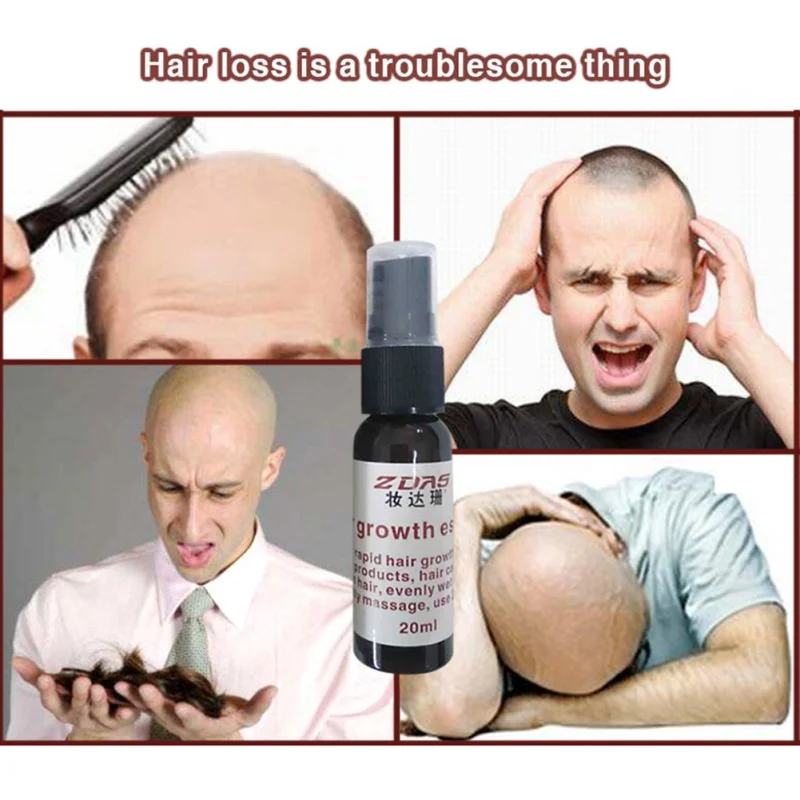 Настоящий продукт от выпадения волос, жидкий спрей для роста волос для женщин и мужчин, увлажняющий крем для Восстановления сухих волос, Мужская сыворотка F2
