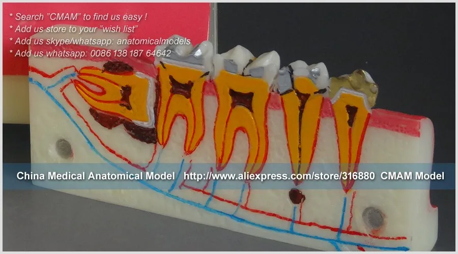 CMAM/12591 зубные зуб сечение, человеческого устные зубоврачебная преподавания анатомическая модель