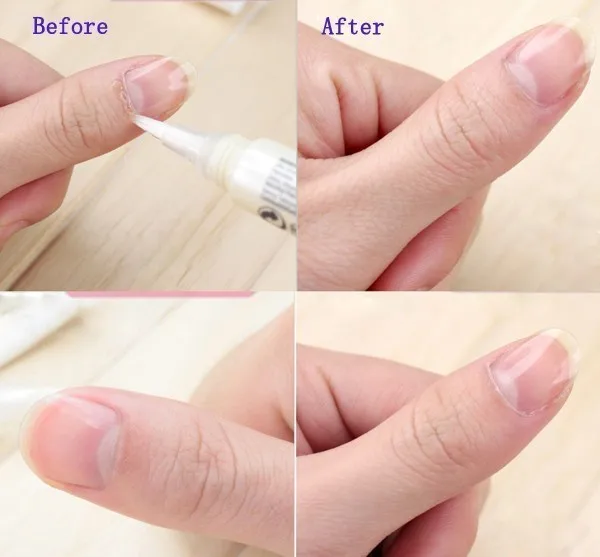 

15 Smells Nutrition Polish Tool Fruit Nail Art Pen 5ml Cuticle Revitalizer Oil Moisturizing Skin Cuticle Nail Treatment Prevent