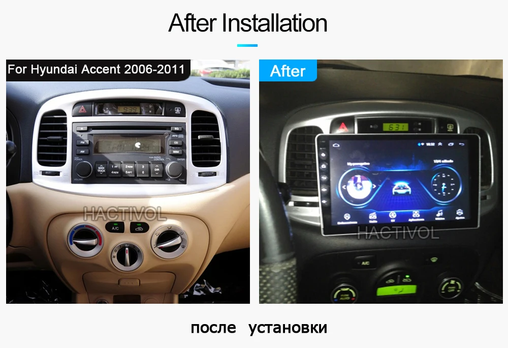 Повесить XIAN 9 "четырехъядерный Android 8,1 автомобильный Радио для hyundai Accent 2006-2011 Автомобильный dvd-плеер gps навигация автомобильный