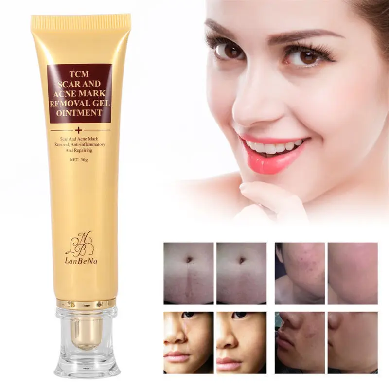 

LANBENA Acne Scar Removal Cream Skin Repair Face Cream Acne Spots Acne Treatment Blackhead Whitening Cream Stretch Marks TSLM2