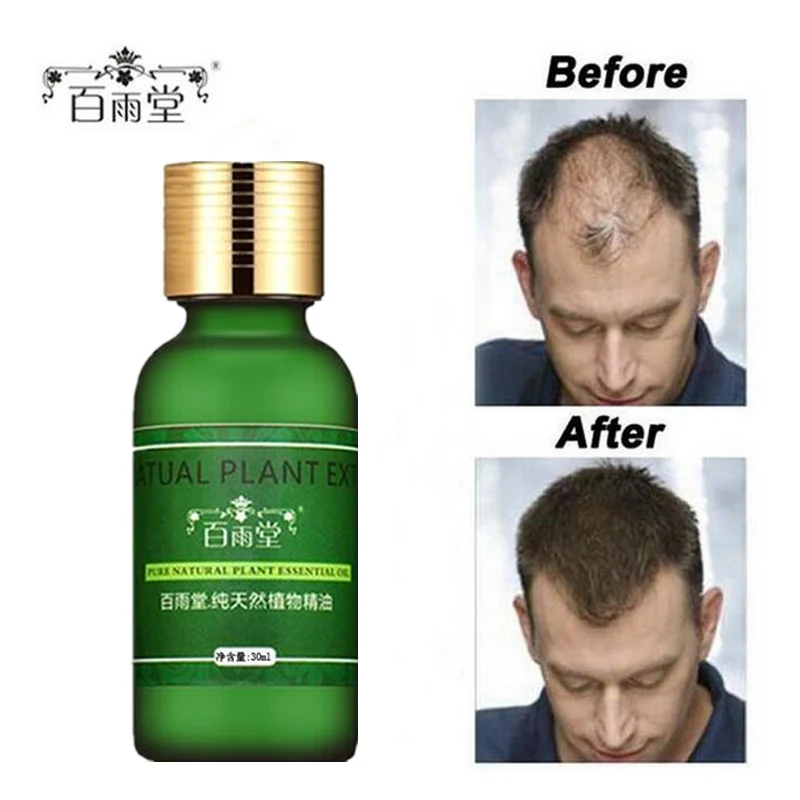 Hair Care Growth Essential Oils Essence Original Authentic 100% Hair Loss Liquid Health Care Beauty Dense Growth Serum east moon hair care spray repair hairs root dense