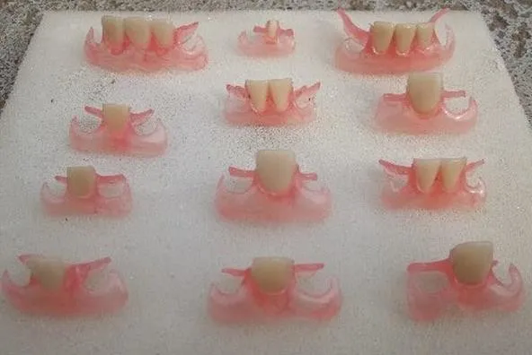 Накладка бабочка зубная