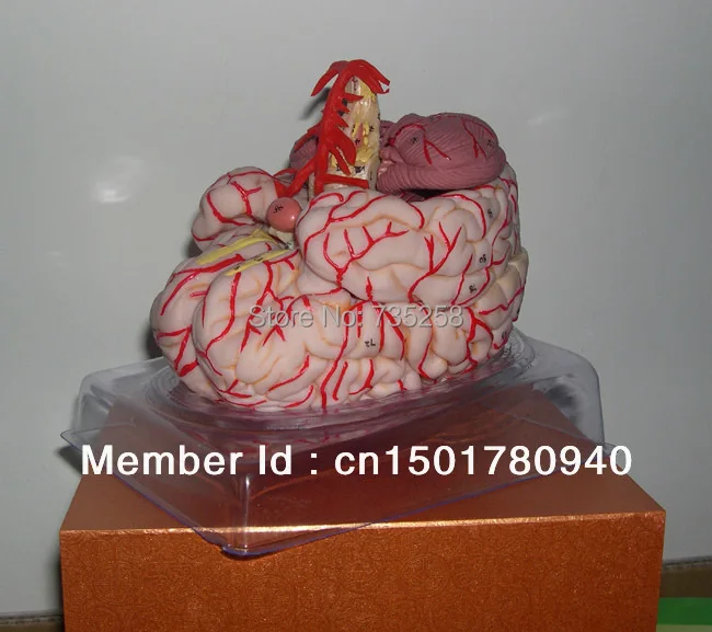 Модель мозговой артерии, анатомическая модель мозга, церебральная артерия модель рассечения